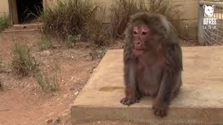 Mrs. Wilkin Bone Deformities